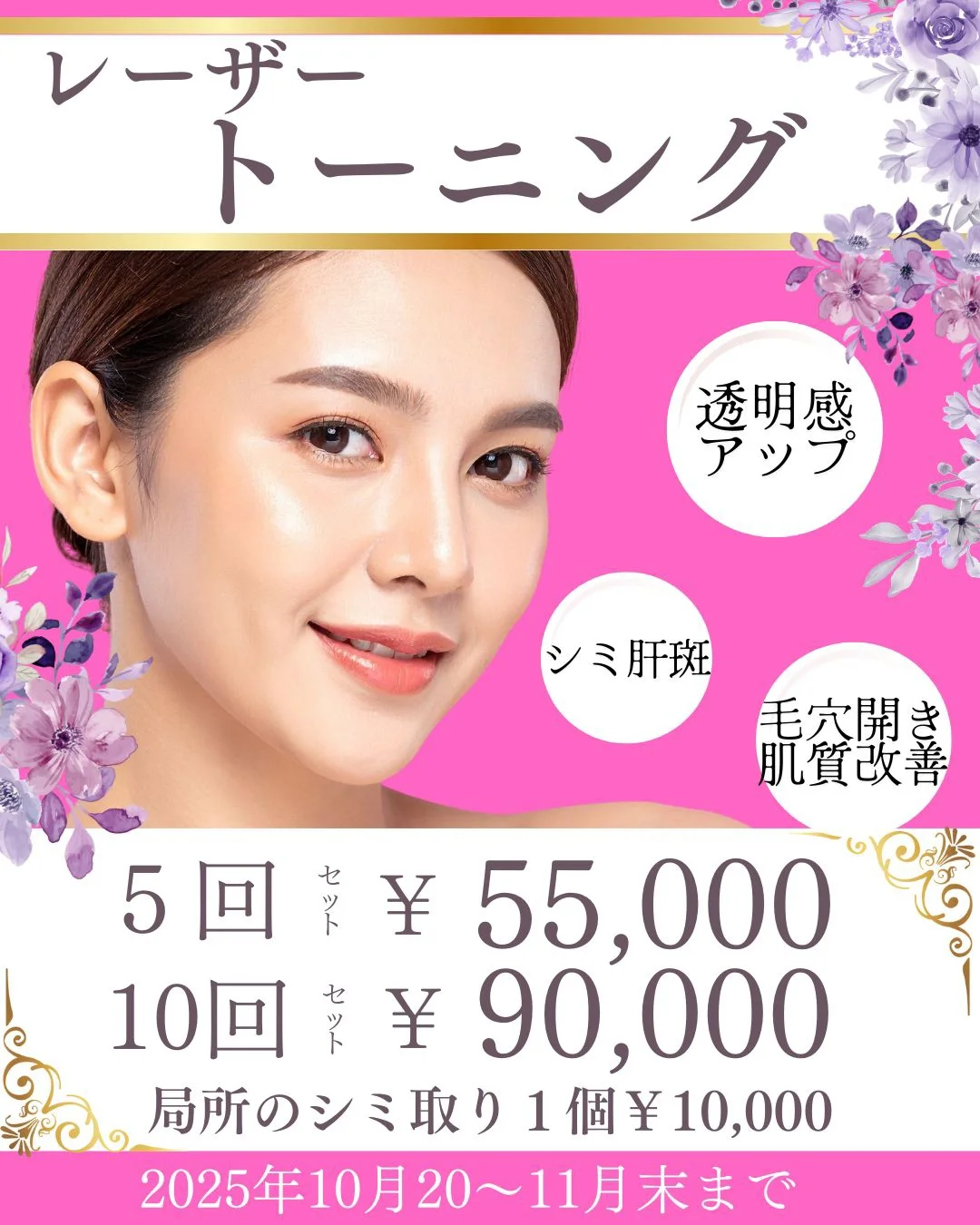 レーザートーニング